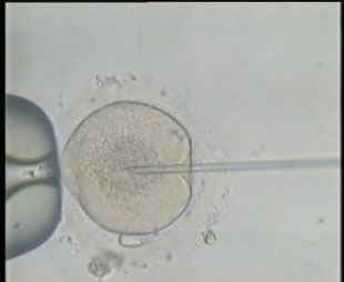 صور من عمليات اطفال الانابيب 2