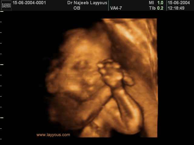 جنين يقود معزوفة اوركسترا